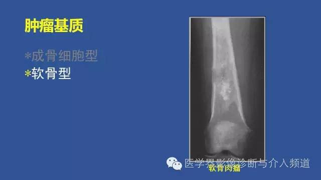【PPT】识骨寻踪