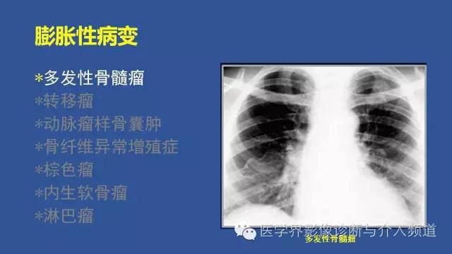 【PPT】识骨寻踪