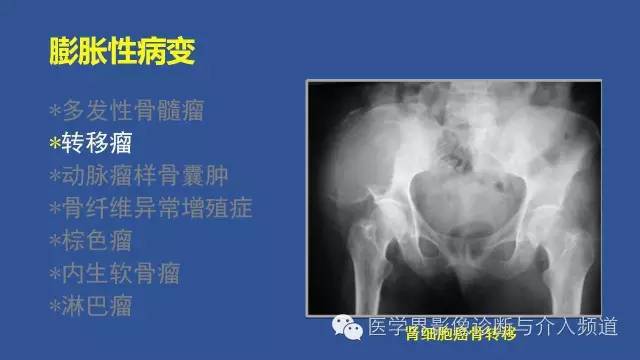 【PPT】识骨寻踪
