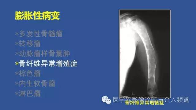 【PPT】识骨寻踪
