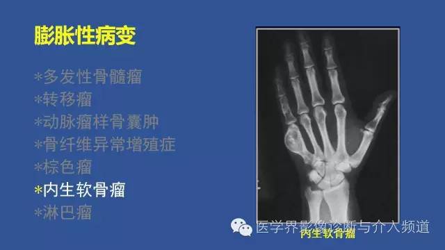 【PPT】识骨寻踪