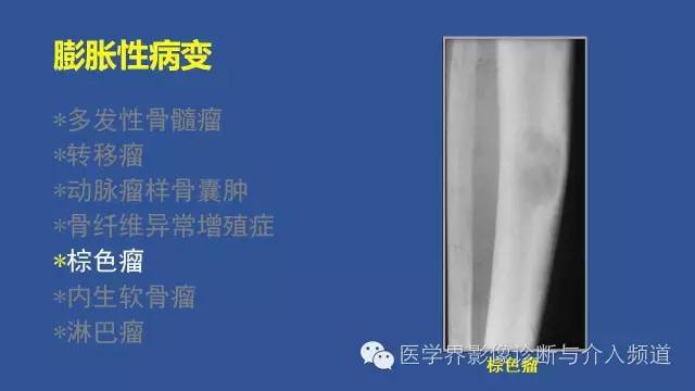 【PPT】识骨寻踪