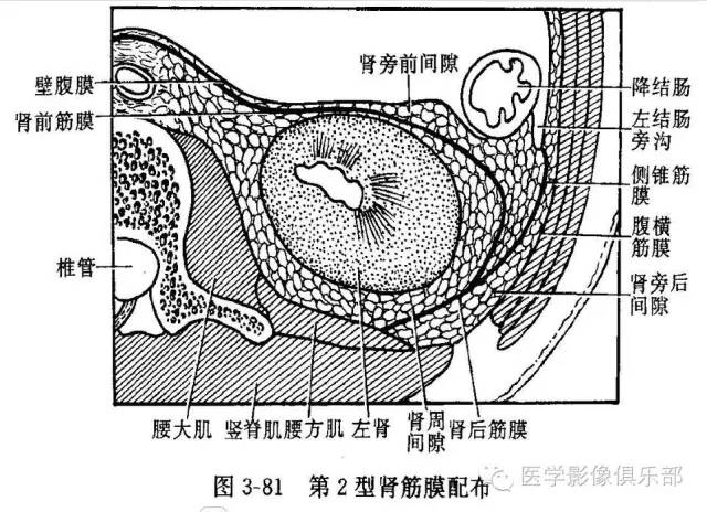 【PPT】急性胰腺炎CT评价