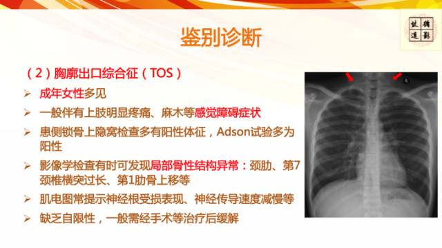 【病例】平山病1例MR影像表现