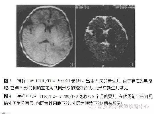 新生儿、婴儿正常脑发育指数测量