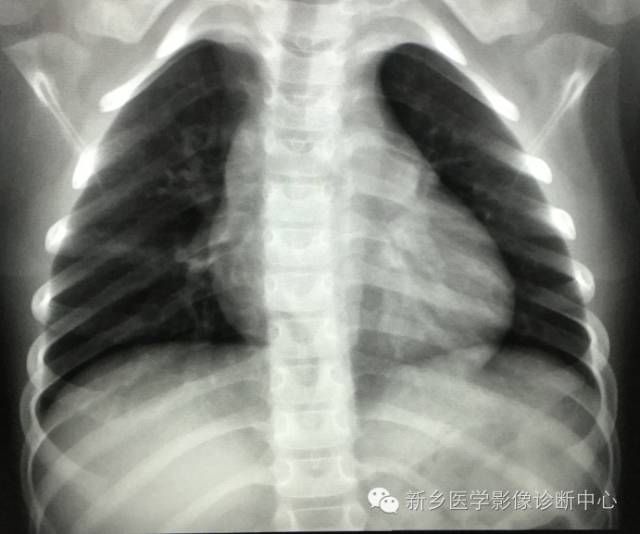 19幅胸腺图片，挑战您的见识