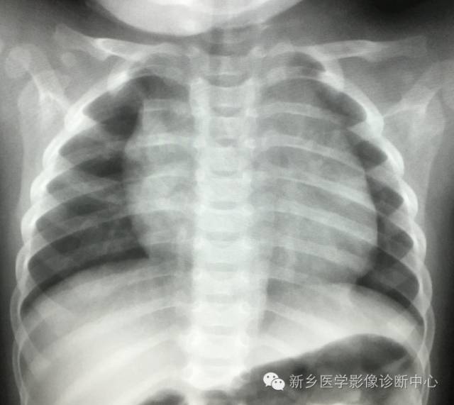 19幅胸腺图片，挑战您的见识