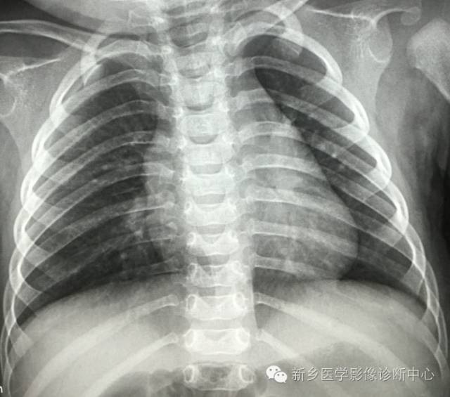 19幅胸腺图片，挑战您的见识