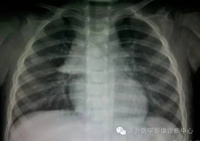 19幅胸腺图片，挑战您的见识