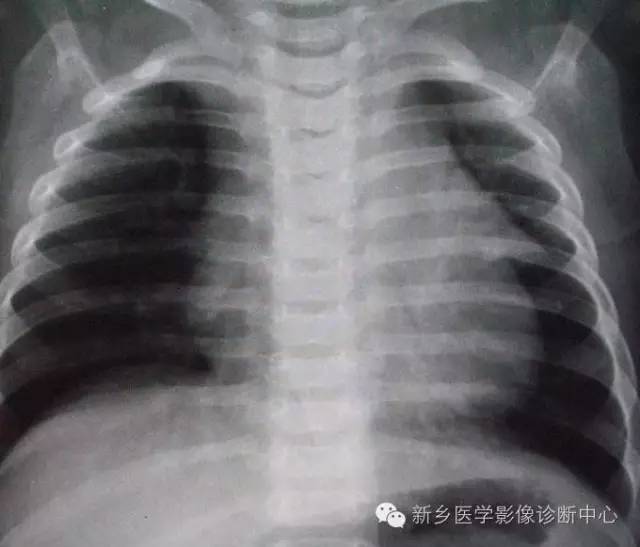 19幅胸腺图片，挑战您的见识