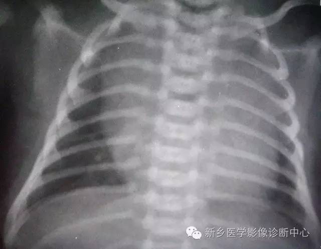 19幅胸腺图片，挑战您的见识
