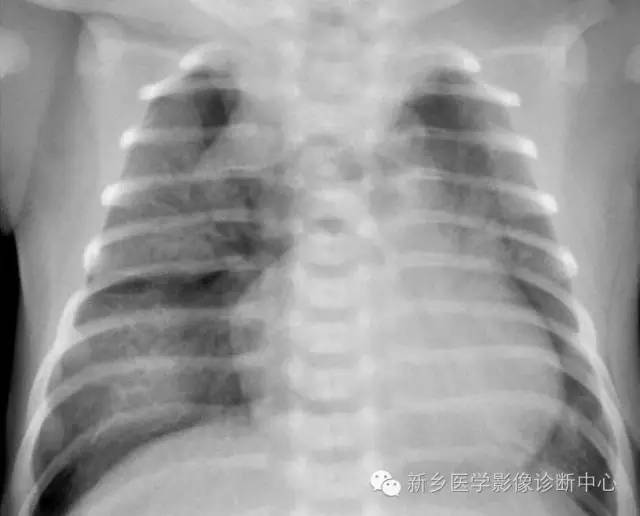 19幅胸腺图片，挑战您的见识