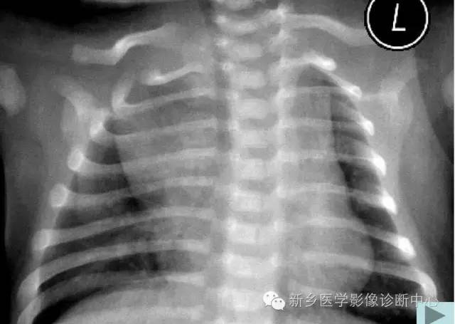 19幅胸腺图片，挑战您的见识