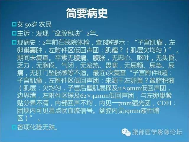【病例】卵巢卵泡膜纤维瘤1例CT影像表现