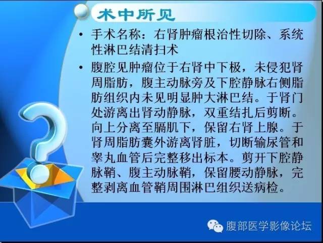 【病例】右肾上皮样血管平滑肌脂肪瘤1例 【病例】右肾上皮样血管平滑肌脂肪瘤1例