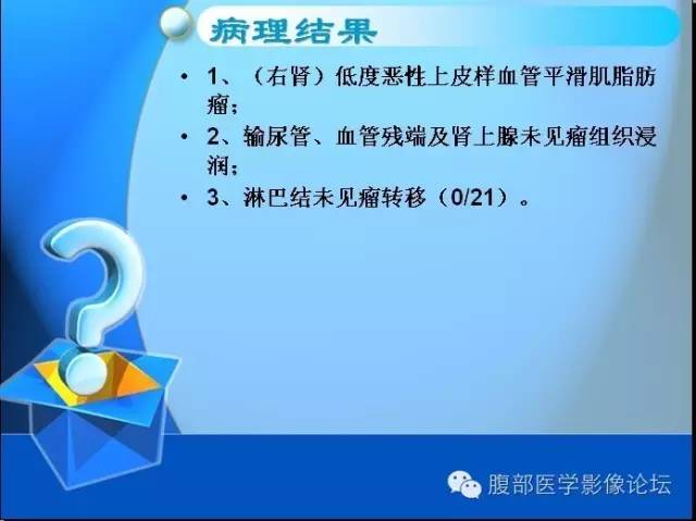 【病例】右肾上皮样血管平滑肌脂肪瘤1例 【病例】右肾上皮样血管平滑肌脂肪瘤1例