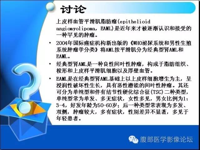 【病例】右肾上皮样血管平滑肌脂肪瘤1例 【病例】右肾上皮样血管平滑肌脂肪瘤1例
