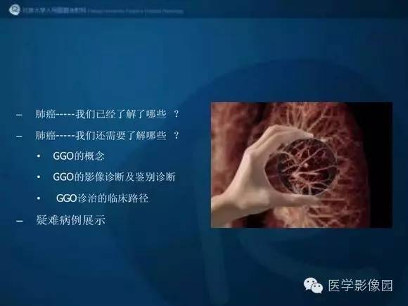 【PPT】肺部GGO的影像与病理