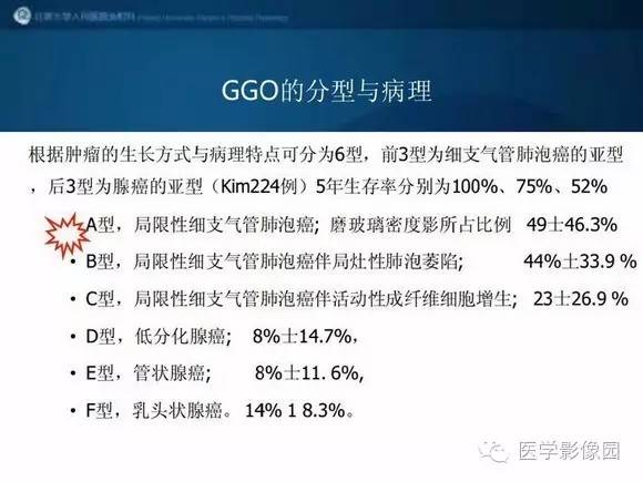 【PPT】肺部GGO的影像与病理