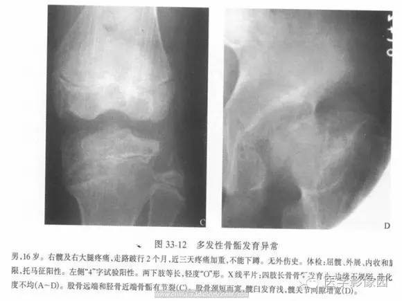 【PPT】骨与软骨发育异常