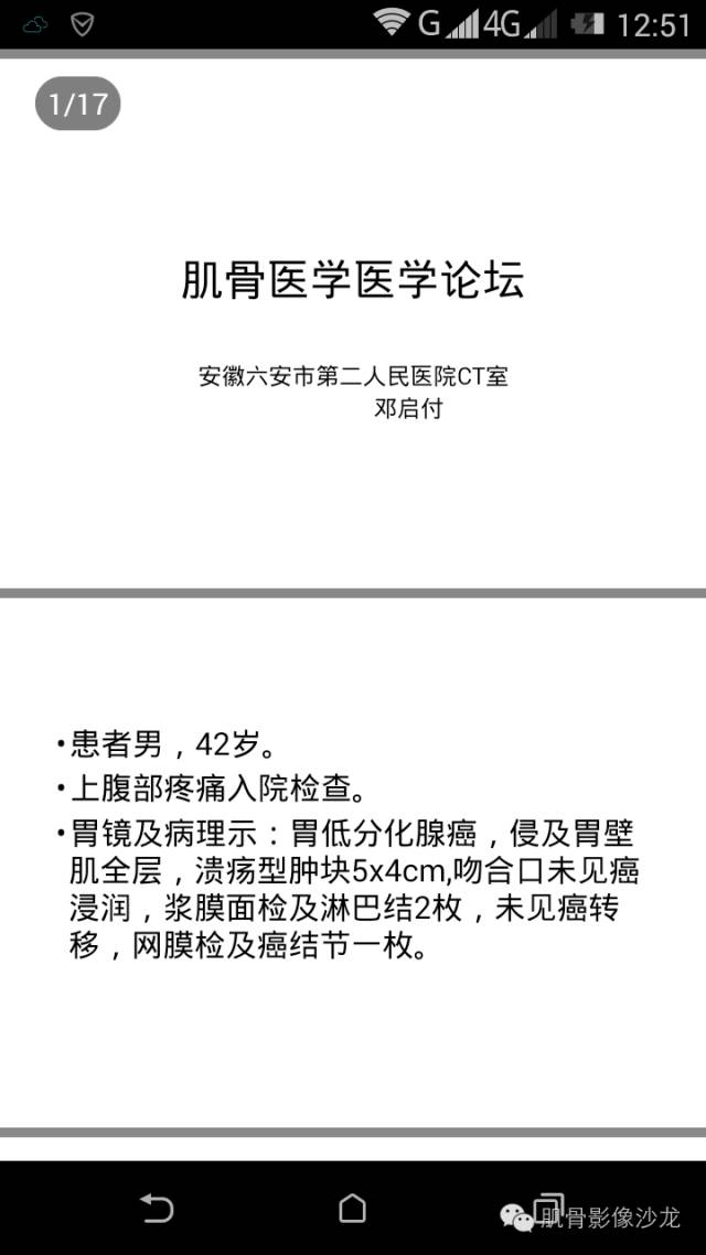 【病例】肋骨骨化性纤维瘤一例CT病例讨论