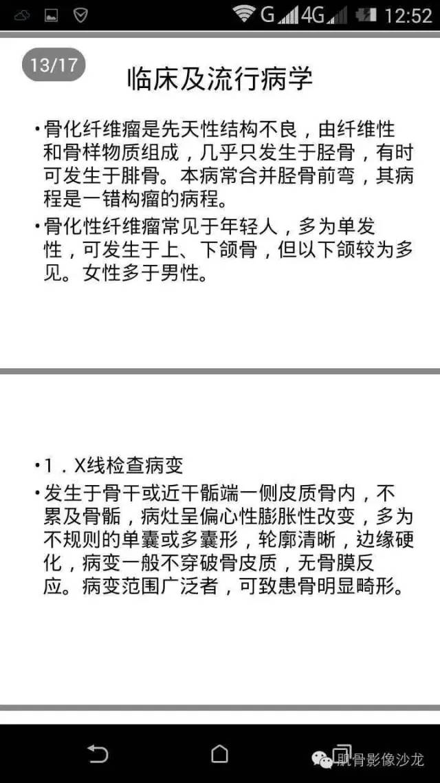 【病例】肋骨骨化性纤维瘤一例CT病例讨论