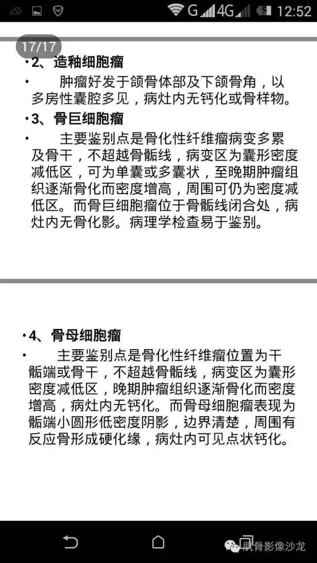 【病例】肋骨骨化性纤维瘤一例CT病例讨论