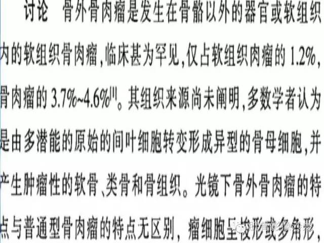 【病例】骨外骨肉瘤1例X线MR