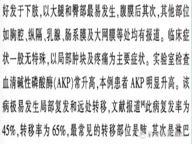 【病例】骨外骨肉瘤1例X线MR