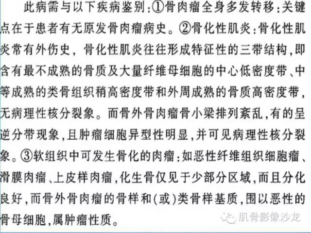 【病例】骨外骨肉瘤1例X线MR