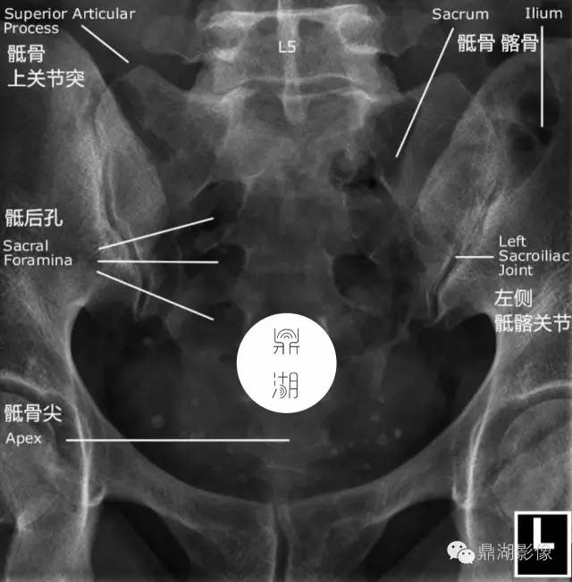 骶骨X线解剖