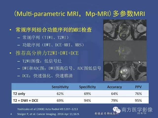 【PPT】前列腺影像报告和数据系统