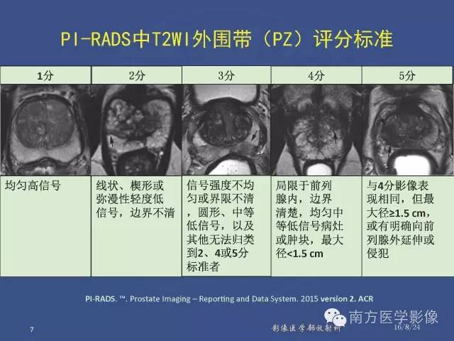 【PPT】前列腺影像报告和数据系统