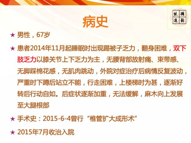 【病例】硬脊膜动静脉瘘1例MR影像表现