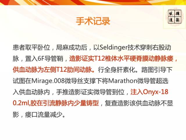 【病例】硬脊膜动静脉瘘1例MR影像表现