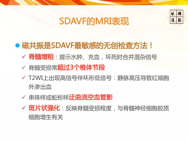 【病例】硬脊膜动静脉瘘1例MR影像表现