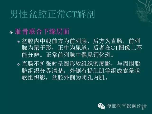 【PPT】盆腔病变的CT诊断