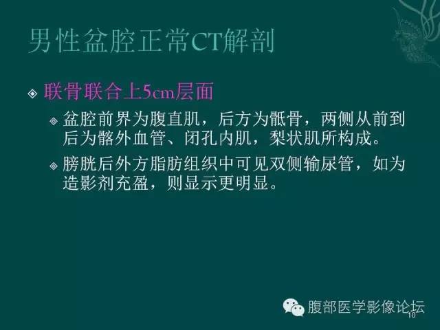 【PPT】盆腔病变的CT诊断