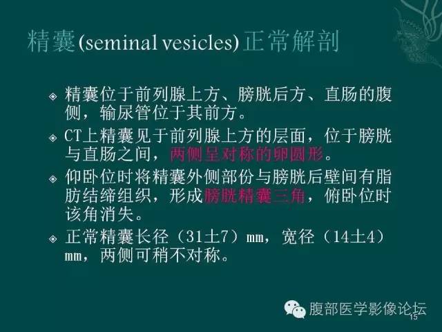 【PPT】盆腔病变的CT诊断