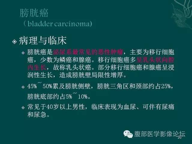 【PPT】盆腔病变的CT诊断