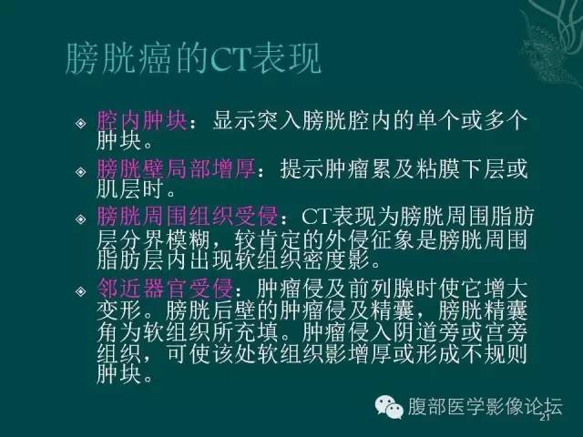 【PPT】盆腔病变的CT诊断