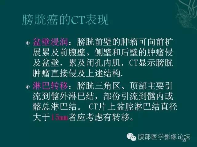 【PPT】盆腔病变的CT诊断