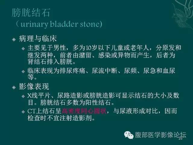 【PPT】盆腔病变的CT诊断