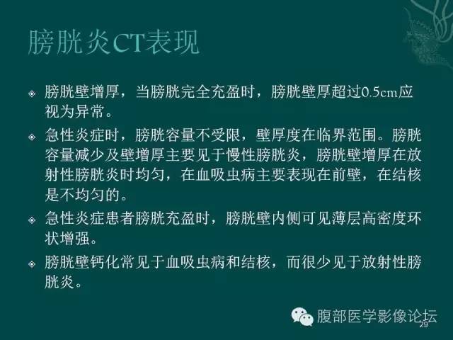 【PPT】盆腔病变的CT诊断