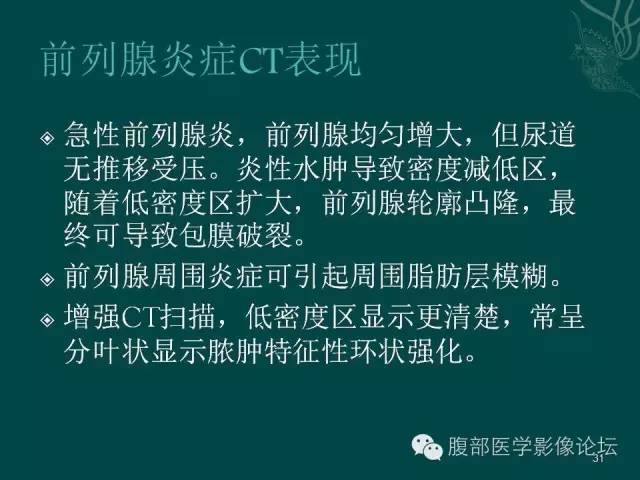 【PPT】盆腔病变的CT诊断