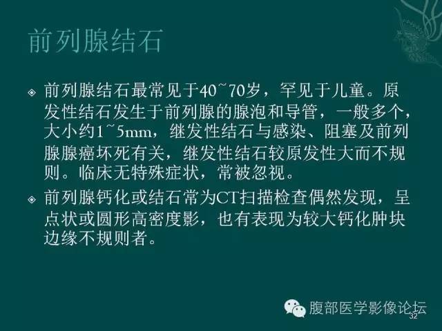 【PPT】盆腔病变的CT诊断