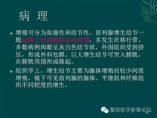 【PPT】盆腔病变的CT诊断