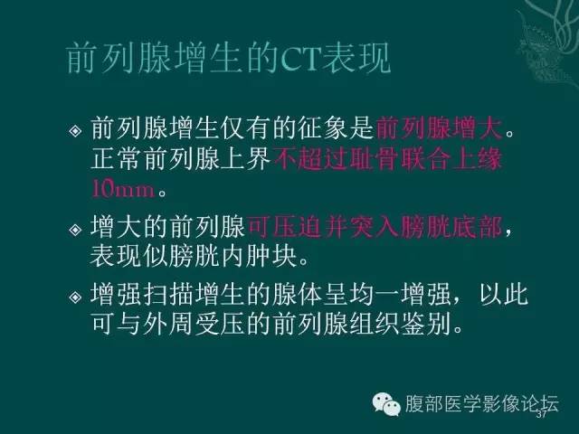 【PPT】盆腔病变的CT诊断