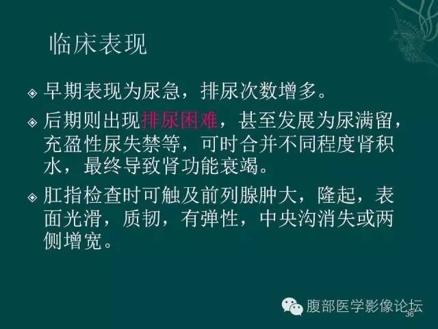【PPT】盆腔病变的CT诊断