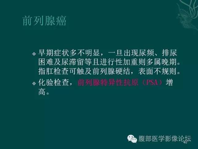 【PPT】盆腔病变的CT诊断